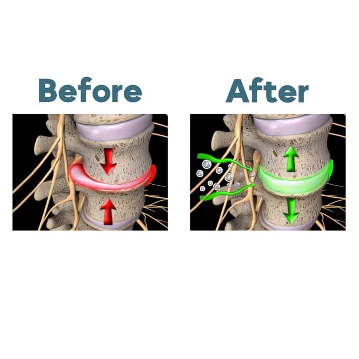 Triple Fusion Back Massager